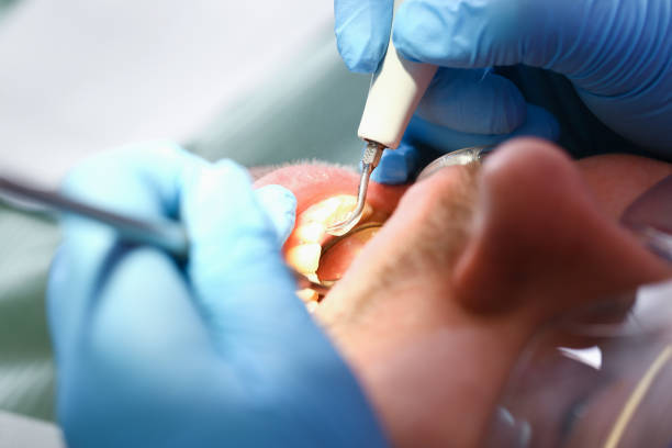 Best Pediatric Emergency Dentist in Lindon, UT