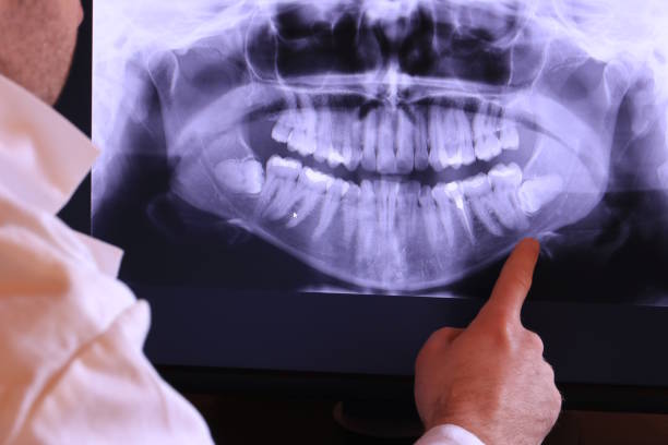 Best Orthodontic Emergency Dentist in Lindon, UT
